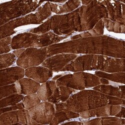 Rapsyn Antibody, Novus Biologicals:Antibodies:Primary Antibodies